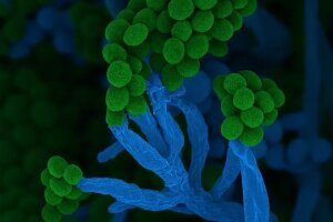 Penicillium-eingefaerbt-rechte-kueck-und-hoff 3zu2